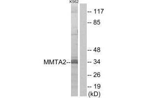 Western blot analysis of extracts from K562 cells, using MMTA2 antibody. (C1orf35 Antikörper  (N-Term))