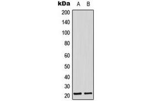 Western blot analysis of Adrenomedullin expression in MCF7 (A), mouse lung (B) whole cell lysates. (Adrenomedullin Antikörper  (Center))