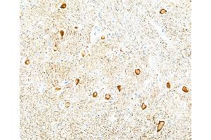 Immunohistochemistry (IHC) image for anti-Neurofilament, Light Polypeptide (NEFL) (AA 150-200) antibody (ABIN7453980) (Rekombinanter NEFL Antikörper  (AA 150-200))