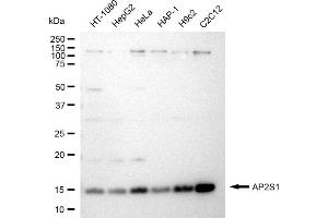Western blotting analysis using AP2S1 antibody (ABIN7797511).