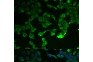 Immunofluorescence analysis of HeLa cells using C1R Polyclonal Antibody (C1R Antikörper)