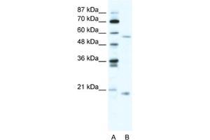 Western Blotting (WB) image for anti-Zinc Finger Protein 18 (ZNF18) antibody (ABIN2460737) (ZNF18 Antikörper)