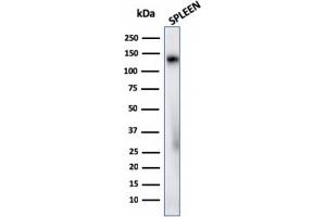 Western Blot Analysis of human Spleen tissue lysate using CD68 Rabbit Recombinant Monoclonal Antibody (C68/2908R). (Rekombinanter CD68 Antikörper)