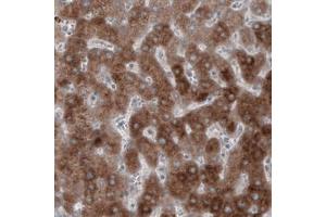 Immunohistochemical staining (Formalin-fixed paraffin-embedded sections) of human liver with HMGCR monoclonal antibody, clone CL0259  shows strong cytoplasmic immunoreactivity. (HMGCR Antikörper)