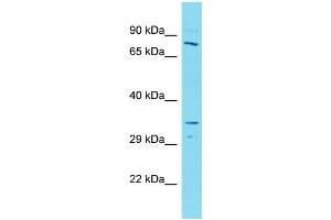 Host:  Rabbit  Target Name:  SMARCB1  Sample Type:  Lymph Node Tumor lysates  Antibody Dilution:  1. (SMARCB1 Antikörper  (N-Term))