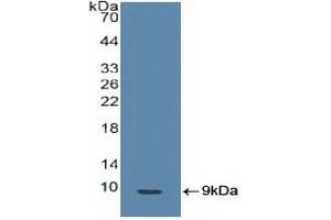 Detection of Recombinant BRCA1, Human using Polyclonal Antibody to Breast Cancer Susceptibility Protein 1 (BRCA1) (BRCA1 Antikörper  (AA 19-83))