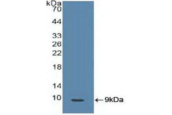 BRCA1 Antikörper  (AA 19-83)