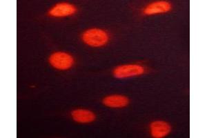 ABIN6267691 staining HeLa cells by ICC/IF. (RACGAP1 Antikörper  (pSer387))
