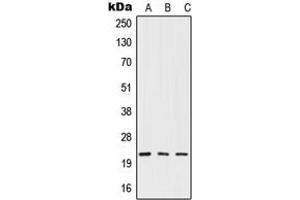 Western blot analysis of IFN beta expression in HepG2 (A), mouse liver (B), rat liver (C) whole cell lysates. (IFNB1 Antikörper  (Center))