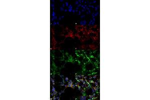 Immunocytochemistry/Immunofluorescence analysis using Mouse Anti-Dityrosine Monoclonal Antibody, Clone 10A6 (ABIN5067484). (Dityrosine Antikörper  (PerCP))