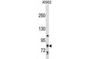 Western Blotting (WB) image for anti-Glycosyltransferase 25 Domain Containing 2 (GLT25D2) antibody (ABIN2999969) (GLT25D2 Antikörper)