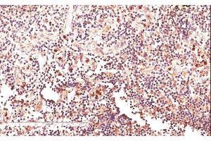 ABIN185585 (4µg/ml) staining of paraffin embedded Human Lymph Node. (GLI2 Antikörper  (Internal Region))