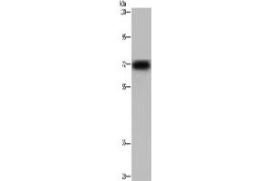 Gel: 6 % SDS-PAGE, Lysate: 40 μg, Lane: Mouse heart tissue, Primary antibody: ABIN7129956(KCND3 Antibody) at dilution 1/700, Secondary antibody: Goat anti rabbit IgG at 1/8000 dilution, Exposure time: 30 seconds (KCND3 Antikörper)
