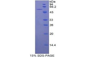 SDS-PAGE analysis of Mouse bACE1 Protein. (BACE1 Protein)