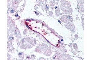 Immunohistochemical (Formalin/PFA-fixed paraffin-embedded sections) staining in human vascular endothelium with HUNK polyclonal antibody . (HUNK Antikörper)