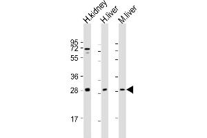 All lanes : Anti-SIRT3 Antibody (C-term) at 1:2000 dilution Lane 1: human kidney lysate Lane 2: human liver lysate Lane 3: mouse liver lysate Lysates/proteins at 20 μg per lane. (SIRT3 Antikörper  (C-Term))