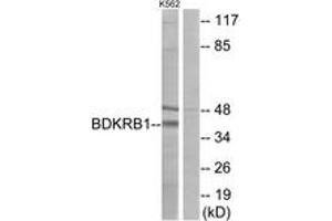 Western blot analysis of extracts from K562 cells, using BDKRB1 Antibody. (BDKRB1 Antikörper  (AA 201-250))