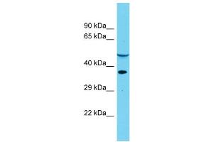 Host: Rabbit Target Name: DUS4L Sample Type: Placenta lysates Antibody Dilution: 1. (DUS4L Antikörper  (Middle Region))