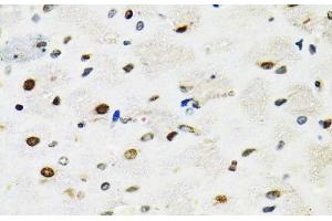 Immunohistochemistry of paraffin-embedded Rat brain using SFPQ Polyclonal Antibody at dilution of 1:100 (40x lens). (SFPQ Antikörper)