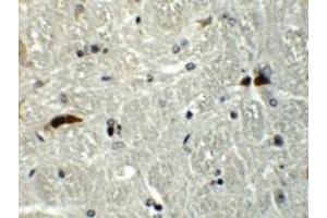 Immunohistochemical staining of mouse brain cells with RABGEF1 polyclonal antibody  at 5 ug/mL. (RABGEF1 Antikörper  (Internal Region))