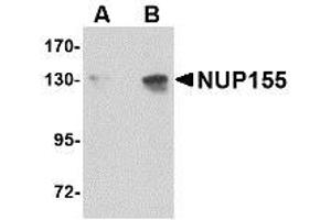 Image no. 1 for anti-Nucleoporin 155kDa (NUP155) (C-Term) antibody (ABIN342687) (NUP155 Antikörper  (C-Term))