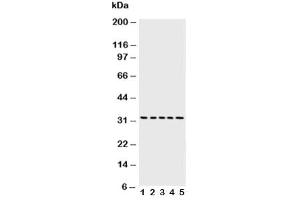 Western blot testing of Caspase-6 antibody and Lane 1:  MCF-7 (Caspase 6 Antikörper  (AA 24-44))