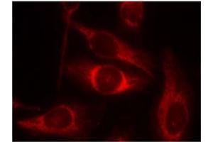 Image no. 2 for anti-Tumor Protein P53 (TP53) (pSer46) antibody (ABIN196787) (p53 Antikörper  (pSer46))