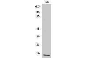 Western Blotting (WB) image for anti-Cyclin-Dependent Kinase Inhibitor 2B (p15, Inhibits CDK4) (CDKN2B) (C-Term) antibody (ABIN3186239) (CDKN2B Antikörper  (C-Term))