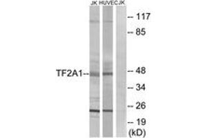 Western blot analysis of extracts from Jurkat/HuvEc cells, using TF2A1 Antibody. (GTF2A1 Antikörper  (AA 281-330))