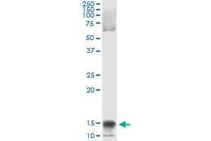 Immunoprecipitation (IP) image for anti-Nuclear Factor of Activated T-Cells, Cytoplasmic, Calcineurin-Dependent 2 Interacting Protein (NFATC2IP) (AA 1-138) antibody (ABIN529822)