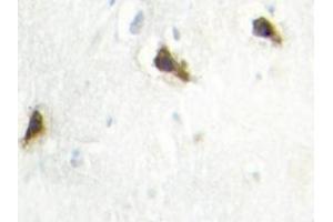 Image no. 2 for anti-Histidyl-tRNA Synthetase (HARS1) antibody (ABIN272164) (HARS1/Jo-1 Antikörper)