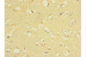 Immunohistochemistry of paraffin-embedded human brain tissue using ABIN7158206 at dilution of 1:100 (Lrig1 Antikörper  (AA 35-220))