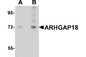 Western Blotting (WB) image for anti-rho GTPase Activating Protein 18 (ARHGAP18) (C-Term) antibody (ABIN1030254) (ARHGAP18 Antikörper  (C-Term))