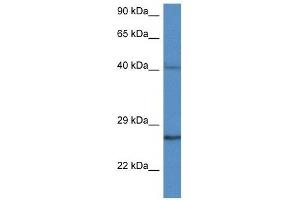Western Blot showing CCS antibody used at a concentration of 1 ug/ml against MDA-MB-435S Cell Lysate (Superoxide dismutase copper chaperone Antikörper  (C-Term))