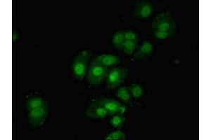 Immunofluorescent analysis of MCF-7 cells using ABIN7142338 at dilution of 1:100 and Alexa Fluor 488-congugated AffiniPure Goat Anti-Rabbit IgG(H+L) (PDPK1 Antikörper  (AA 277-556))