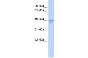 RRM2 antibody used at 1 ug/ml to detect target protein. (RRM2 Antikörper  (N-Term))