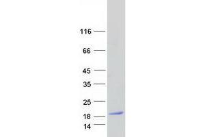 Validation with Western Blot (MAL Protein (Transcript Variant A) (Myc-DYKDDDDK Tag))