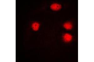 Immunofluorescent analysis of ELF5 staining in HuvEc cells.
