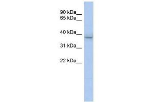 KLHDC8B antibody used at 1 ug/ml to detect target protein.