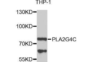 Western blot analysis of extracts of THP-1 cells, using PLA2G4C antibody. (PLA2G4C Antikörper)