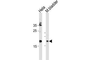 Western Blotting (WB) image for anti-Family with Sequence Similarity 159, Member A (FAM159A) antibody (ABIN3004605) (FAM159A Antikörper)