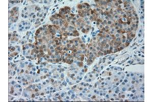 Immunohistochemical staining of paraffin-embedded Kidney tissue using anti-SERPINA1mouse monoclonal antibody. (SERPINA1 Antikörper)