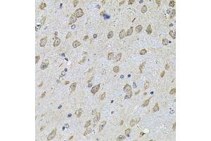 Immunohistochemistry of paraffin-embedded mouse brain using NFU1 Antibody. (NFU1 Antikörper  (AA 1-230))