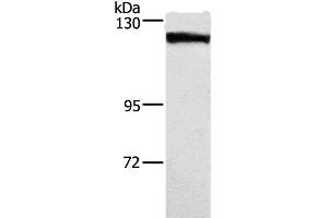 Western Blot analysis of Human tongue cancer tissue using DSG1 Polyclonal Antibody at dilution of 1:750 (Desmoglein 1 Antikörper)