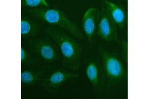 IF analysis of DDX6 using anti-DDX6 antibody (ABIN7602044).