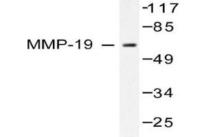 Image no. 2 for anti-Matrix Metallopeptidase 19 (MMP19) antibody (ABIN265528)