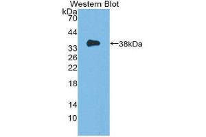 Western Blotting (WB) image for anti-Induced Myeloid Leukemia Cell Differentiation Protein Mcl-1 (MCL1) (AA 6-328) antibody (ABIN1869117) (MCL-1 Antikörper  (AA 6-328))