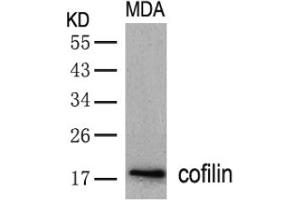Image no. 2 for anti-Cofilin 1 (CFL1) (AA 1-5), (N-Term) antibody (ABIN197372) (Cofilin Antikörper  (N-Term))