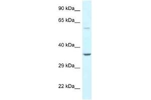 Western Blot showing BAG5 antibody used at a concentration of 1 ug/ml against Hela Cell Lysate