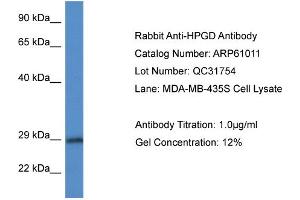 Western Blotting (WB) image for anti-Hydroxyprostaglandin Dehydrogenase 15-(NAD) (HPGD) (N-Term) antibody (ABIN2788653) (HPGD Antikörper  (N-Term))